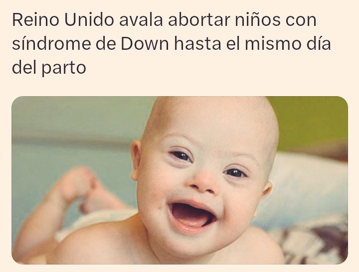 Sondeo Tuitero 

Está de acuerdo que aborten a bebés con síndrome de Down?

NO: 🔄
SÍ: ♥️
.
.