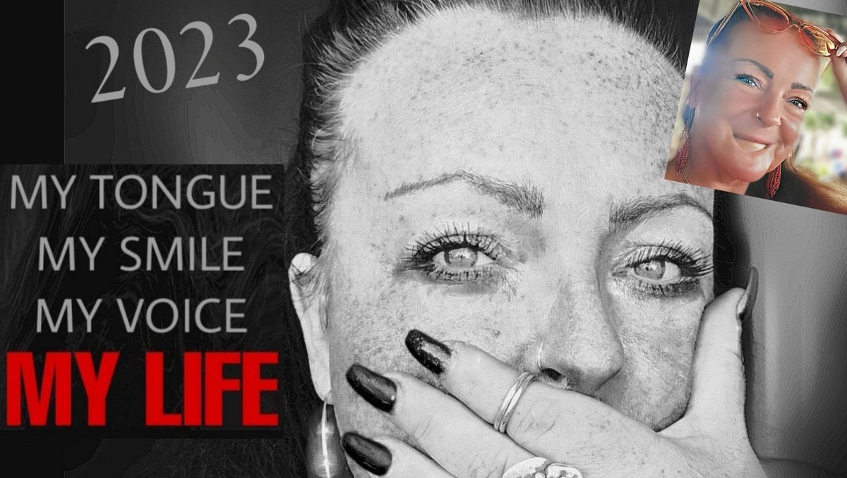 "SAVE MY VOICE 2023!" 
It's a year since my jaw reconstructive surgery in India. It was a success! We are now starting the fundraiser again, for my second surgery.
I need your HELP once more.
All my love ❤️

Please Share &amp; Donate to my GoFundMe: gofund.me/c71ec684 #GoFundMe