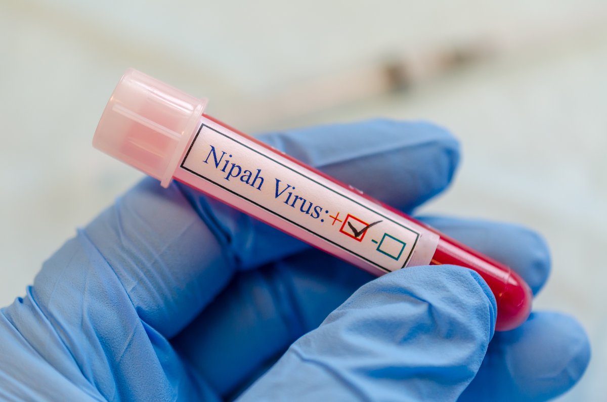 UHN_Plus's tweet photo. 🚨 INFORMACIÓN SÚPER IMPORTANTE: Todo lo que necesitas saber sobre el Virus NIPAH:

En estos momentos, el mundo vuelve a encontrarse ante una posible emergencia sanitaria debido a la reaparición del virus Nipah, especialmente en la región de Kerala, India. Es fundamental estar informados y tomar las precauciones necesarias. Aquí te contamos todo lo que debes saber:

🦠 ¿Qué es el virus Nipah?
Se trata de un virus zoonótico, lo que significa que puede transmitirse de animales a humanos. Fue identificado por primera vez en 1999 durante un brote en Malasia y Singapur, asociado inicialmente con la exposición a granjas de cerdos.

🔄 ¿Cómo se transmite?
La transmisión puede ocurrir de varias formas:

- Contacto directo con animales infectados, como los murciélagos frugívoros y los cerdos.
- Consumo de alimentos contaminados, como frutas o frutos contaminados con saliva o excremento de murciélagos.
- De persona a persona, a través de fluidos corporales de una persona infectada.

💊 ¿Cuáles son los síntomas?
Los afectados pueden presentar síntomas que varían desde problemas respiratorios hasta encefalitis (inflamación del cerebro), y en casos graves, coma. Es fundamental estar atentos a síntomas como fiebre, dolores musculares, y dolor de garganta, ya que pueden ser señales tempranas de la infección.

⚕️ Tratamiento:
Hasta el momento, no existe una vacuna o tratamiento específico para el virus Nipah. El tratamiento es sintomático y de soporte, buscando aliviar los síntomas mientras el sistema inmunológico del paciente combate el virus.

✋🏻 Prevención:
Aunque no hay un tratamiento específico, podemos tomar medidas para prevenir la infección:
- Evita el contacto cercano con personas enfermas.
- Lava tus manos frecuentemente con agua y jabón.
- Evita consumir frutas y líquidos contaminados.

🔍 Para más información, se recomienda seguir las actualizaciones de los organismos de salud locales e internacionales.

🙏 Mantente seguro y protege a tus seres queridos estando bien informado. 

Comparte esta información para que más personas estén al tanto y síguenos si quieres recibir más actualizaciones y noticias sobre el tema.