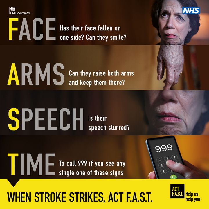 If you see someone with any of the signs or symptoms of a stroke, remember to Act F.A.S.T. F – Face (has their face fallen on one side?) A – Arms (can they raise both arms and keep them there?) S – Speech (is it slurred?) T – Time to call 999 nhs.uk/actFAST