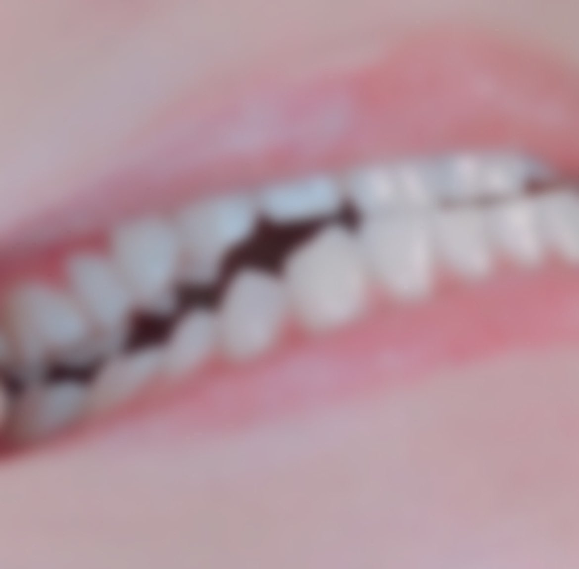 Uo5V54's tweet photo. おはようございます！☀

こちらのモザイク無しを購入したい方はリツイートやいいねをよろしくお願いします！

画質は昨日の舌出し画像みたいに鮮明で見れます！🤭
#唾液販売　#唾液売ります　#舌フェチ　#歯フェチ https://t.co/gVEtLixgck