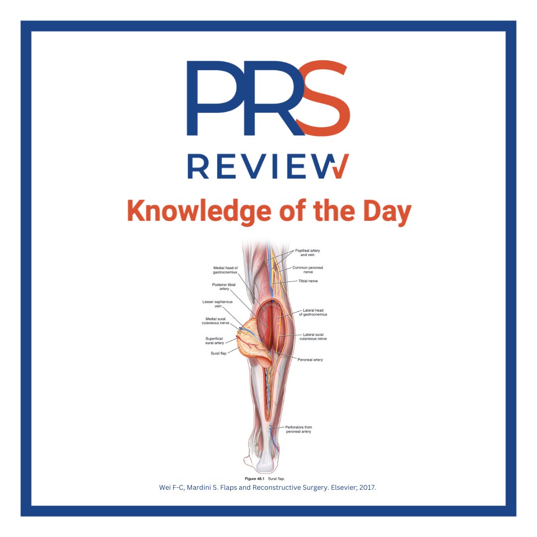 prsreview's tweet photo. Reverse sural flap
#prsreview #reversesuralflap #flap #flapsurgery #superficialsuralartery #anatomy #flapanatomy #microsurgery #plasticsurgery #reconstructivesurgery #orthopedicsurgery #surgicaleducation #medicaleducation #meded #plasticsurgeryresidency #plasticsurgeon #surgery https://t.co/NO3ORpCxGd