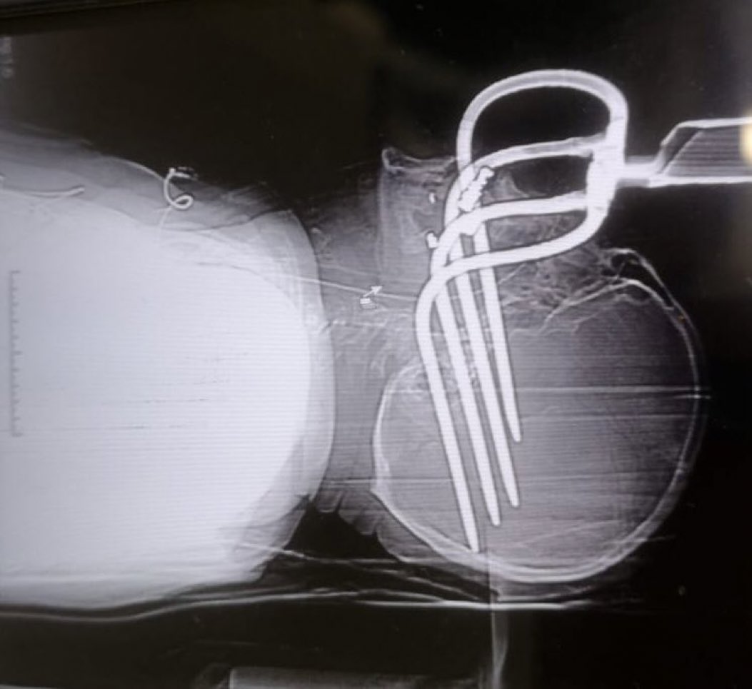 Sam Ghali, M.D. tweet media