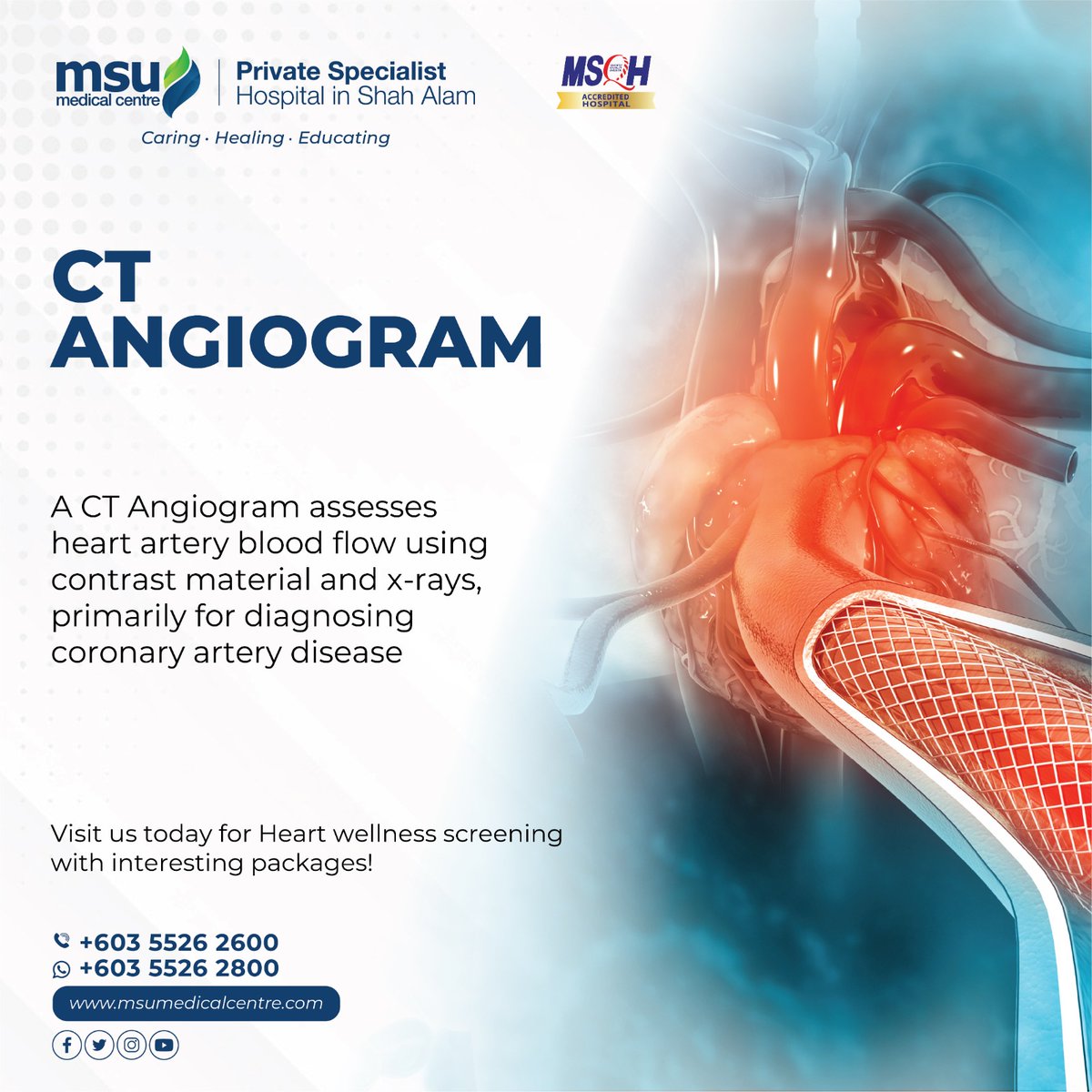 msumcmalaysia's tweet image. CT Angiogram unveils the intriguing landscape of blood vessels.

#caringhealingeducating
#msumc
#ctangiogram