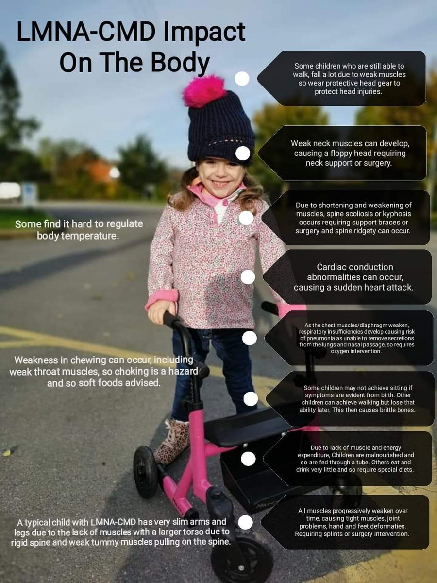 Cure4Carmela's tweet image. It's Muscular Dystrophy Awareness Month.
Here are a few photos to show you what happens to me and others with my very rare type of MD called LMNA-CMD.  It only affects around 1 in a million babies. @MDUK_News
@FoundationLcmd @CureCMD