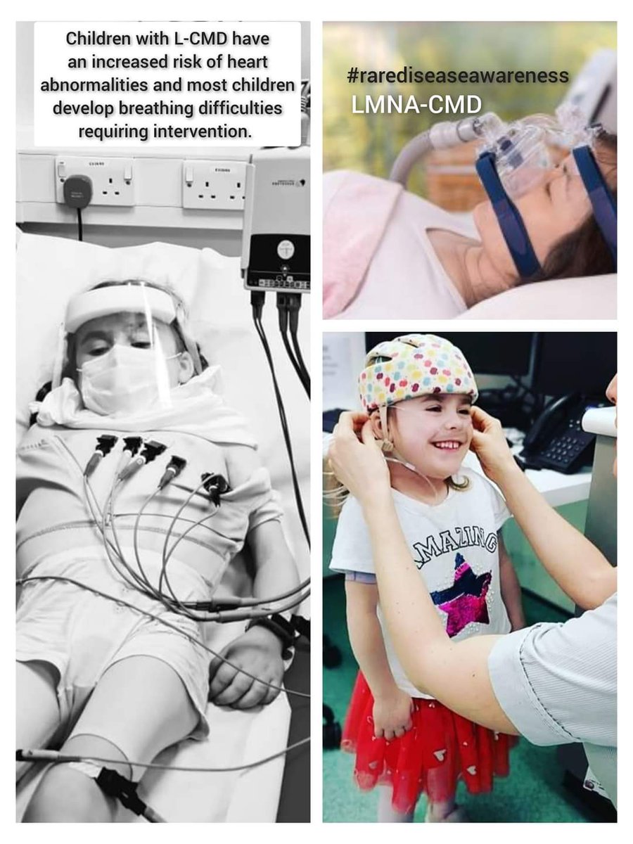 Cure4Carmela's tweet image. It's Muscular Dystrophy Awareness Month.
Here are a few photos to show you what happens to me and others with my very rare type of MD called LMNA-CMD.  It only affects around 1 in a million babies. @MDUK_News
@FoundationLcmd @CureCMD