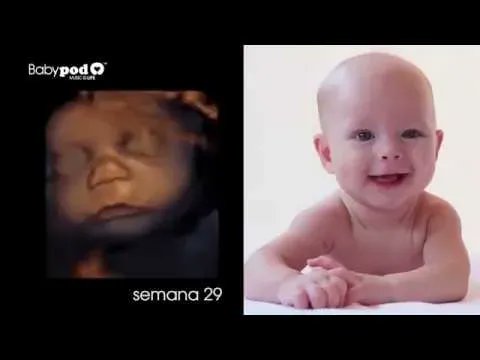 #Babypod: Los movimientos fetales de vocalización pueden apreciarse claramente en ecografía 2D, usando cortes sagitales de la boca: esto nos permitirá visualizar los movimientos de la lengua dentro de la boca, así como los de protrusión. youtube.com/watch?v=MpuIyv…