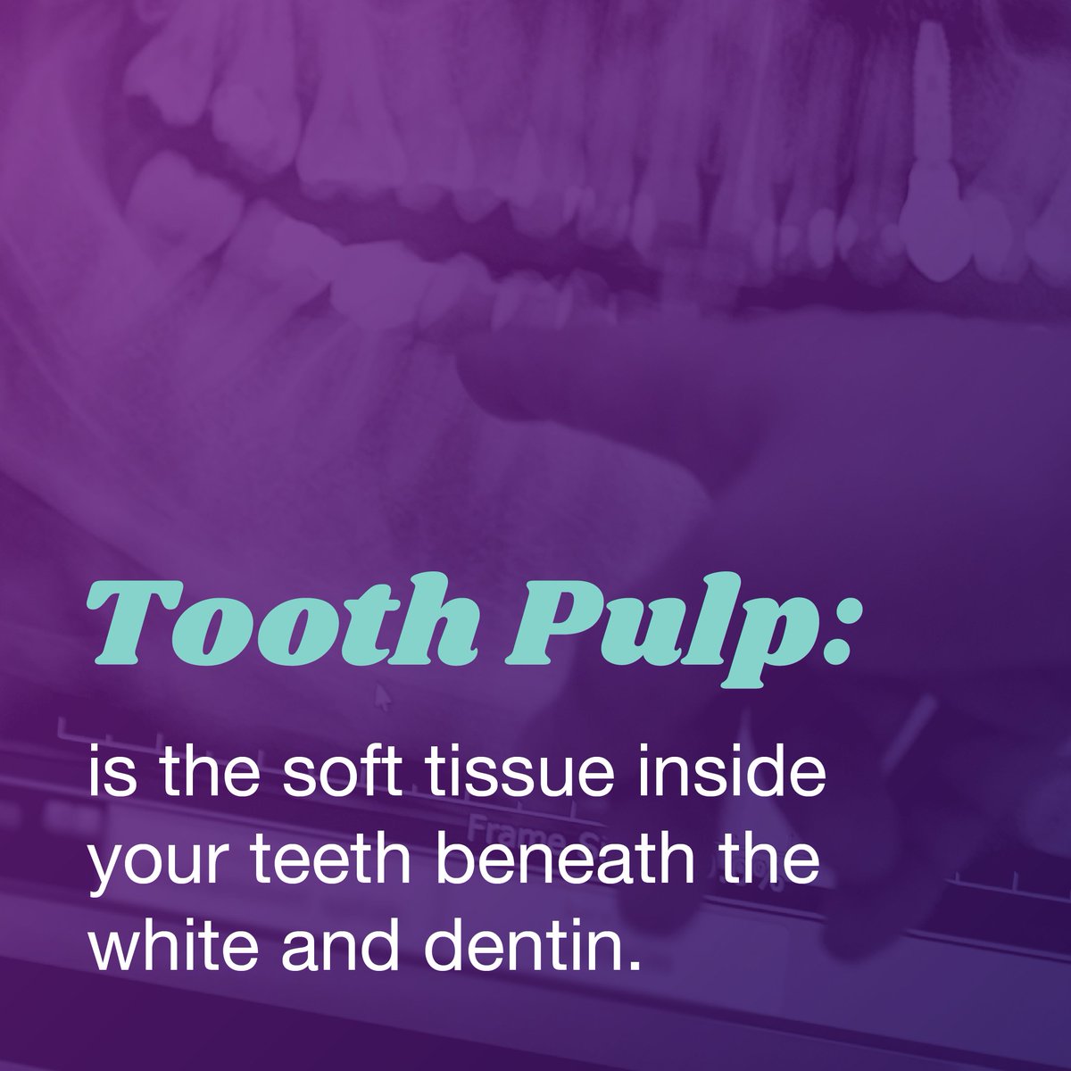 savingyourteeth's tweet photo. Exposed tooth pulp may be the cause of a larger problem 🤔 Don’t ignore your tooth pain; find an endodontist near you through https://t.co/iq7MkdpABo 🔎

#Endodontist #ToothPain #Endodontics #ToothPulp https://t.co/RpAmV7rgnl