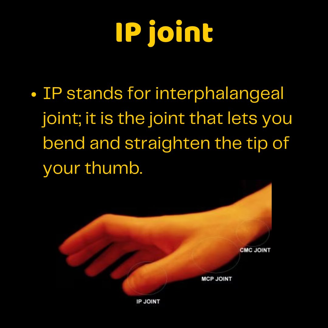 InjuryExplained's tweet photo. #TimSouthee’s thumb injury appears to be an IP joint dislocation with an avulsion (bone chip) fracture. First line of management is splint for 3-6 wks. If not healing, surgery (pin to fix fracture).
WC is 3 wks away, his chances of being ready are very slim
#ICCWorldCup2023 https://t.co/ubnxpzWyzq