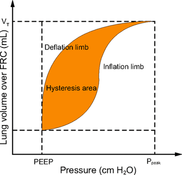respcare's tweet photo. Zheng provides a narrative review on evaluating respiratory mechanics in assessment of lung recruitment.
https://t.co/QWCgFDOm24 https://t.co/3jDq735I6U