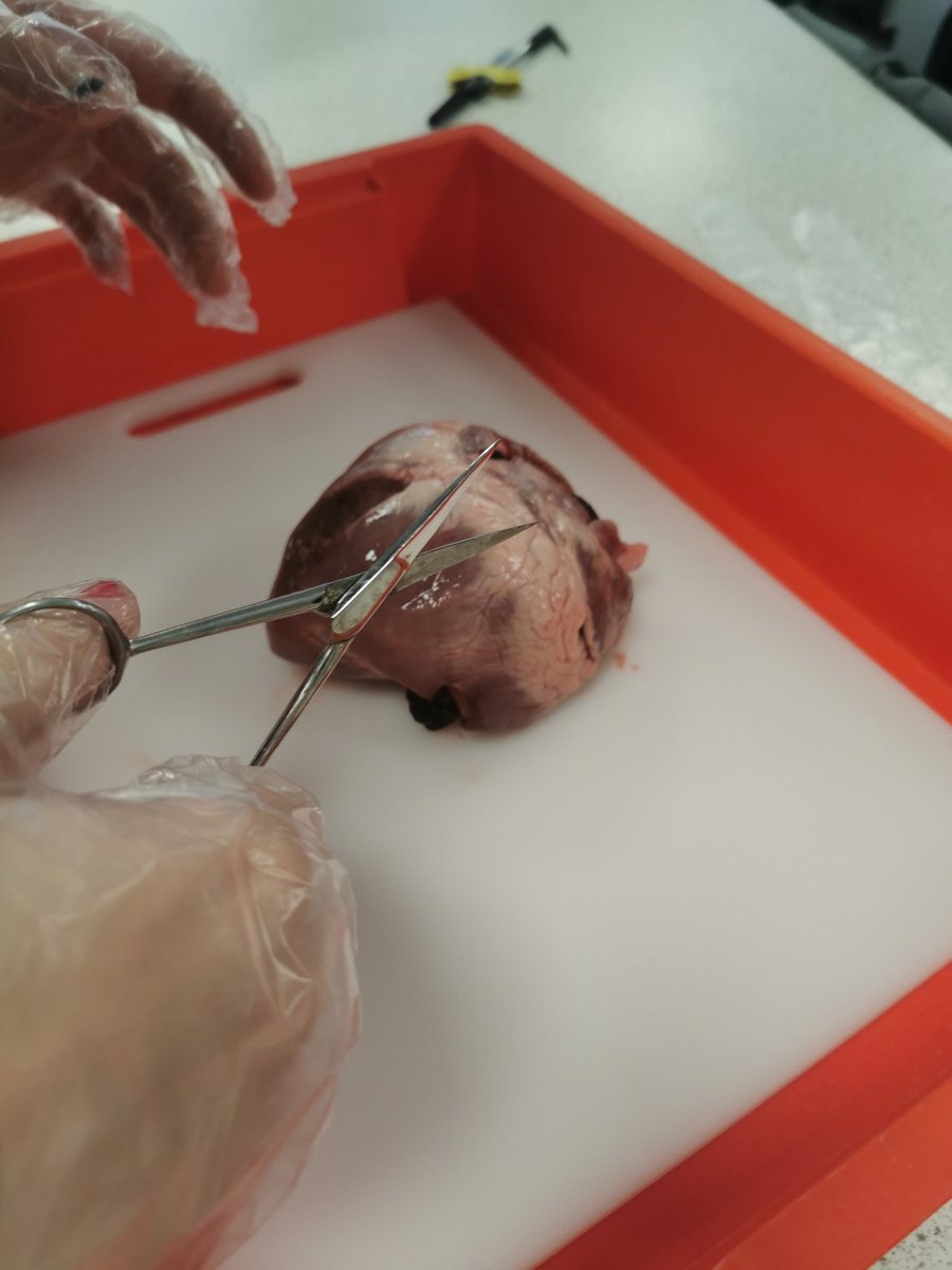MHS_Science_'s tweet photo. Well done 10R1 for dissecting hearts this morning, you were fantastic!
@MaghullHighsch #Science #heartdissection #STEM https://t.co/FTgVyXtXrc