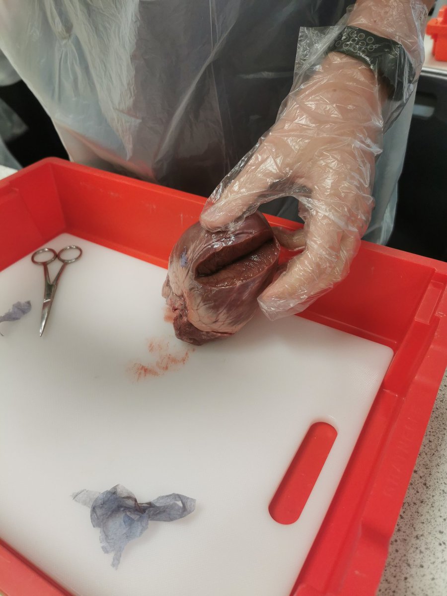 MHS_Science_'s tweet photo. Well done 10R1 for dissecting hearts this morning, you were fantastic!
@MaghullHighsch #Science #heartdissection #STEM https://t.co/FTgVyXtXrc