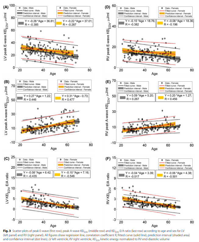 Pankaj Garg (@heartinmagnet) on Twitter photo Age and sex-specific REFERENCE VALUES of biventricular flow components and kinetic energy by #4DflowCMR in health.⬇️
rdcu.be/dmpU0
<a href="/canSCMR/">SCMRI Canada</a> <a href="/SCMRorg/">Society for Cardiovascular Magnetic Resonance</a> <a href="/escardio/">European Society of Cardiology</a> <a href="/BSCMR/">BSCMR</a> <a href="/Cardiac_MRI/">Cardiac MRI</a> <a href="/journalofCMR/">Journal of CMR</a> <a href="/CMRPapers/">CMR Papers</a> <a href="/WHYCMR_BOT/">WHYCMR-BOT</a>
Insightful paper in collaboration with <a href="/lzhongnhc/">Liam Zhong</a> Age and sex-specific REFERENCE VALUES of biventricular flow components and kinetic energy by #4DflowCMR in health.⬇️
rdcu.be/dmpU0
<a href="/canSCMR/">SCMRI Canada</a> <a href="/SCMRorg/">Society for Cardiovascular Magnetic Resonance</a> <a href="/escardio/">European Society of Cardiology</a> <a href="/BSCMR/">BSCMR</a> <a href="/Cardiac_MRI/">Cardiac MRI</a> <a href="/journalofCMR/">Journal of CMR</a> <a href="/CMRPapers/">CMR Papers</a> <a href="/WHYCMR_BOT/">WHYCMR-BOT</a>
Insightful paper in collaboration with <a href="/lzhongnhc/">Liam Zhong</a>