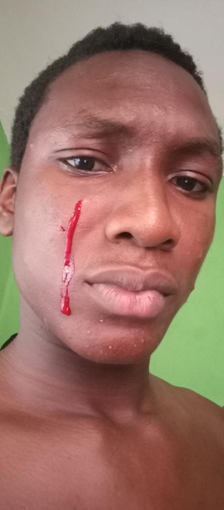 NewLogic354896's tweet photo. @OGBdeyforyou I cried out blood cause of Mohbad https://t.co/OAsYy86gtA