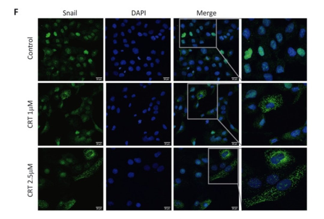 SEMOC_IIBM's tweet photo. 👏🏻Enhorabuena a la Dra. Marina Lasa y a @darii_cillrod7 por el gran trabajo que acaban de publicar.
🔬Todo el trabajo de #microscopia se ha realizado en el #SEMOC del @IIBmCSICUAM
🖥️https://t.co/OhcFgOcF8K https://t.co/TKLdBC9t42