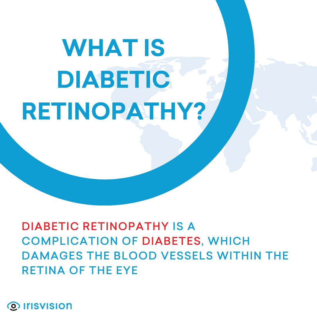 TheIrisVision's tweet image. 👁️ Diabetes isn't just about managing blood sugar; it can also impact your eyesight. 

🔍 Learn more: irisvision.com/vision-loss/

#diabetes #irisvision #eyecondition #eyedisease #visualimpairment #accessibility #lowvision #disability #disabilityawareness #sightloss #visionloss