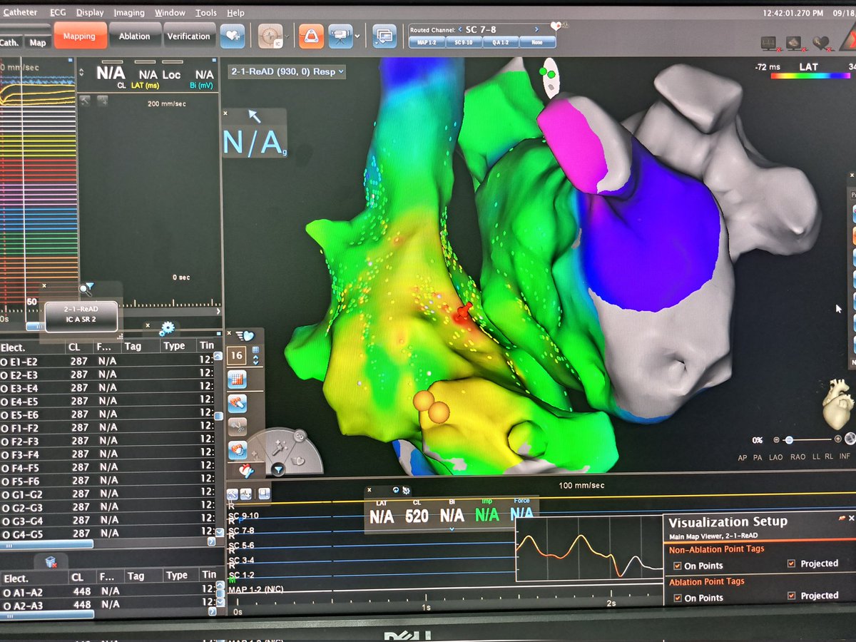 araujojr_nil's tweet photo. First day with #octaray . Great tool. https://t.co/YACYG0hupw