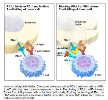 fvalstounge's tweet photo. BriaCell Therapeutics Corporation: 
Understanding the Science Behind a Promising Cancer Therapy

Overview
Treating cancer is hard. This is an obvious statement, but it always bears repeating. This is primarily because cancer has numerous defensive mechanisms to suppress and evade detection or attack by the patient’s immune system. An immunotherapy seeks to use substances to overcome these defense mechanisms and activate the patient’s own immune system to kill the tumors. 

BriaCell Therapeutics Corp. is preparing to initiate a pivotal registration study for their lead candidate, Bria-IMT, which is being used in combination with a checkpoint inhibitor as an immunotherapy for metastatic breast cancer patients. These are patients who have failed multiple prior treatments and have very few, if any, options remaining. While earlier trials have been very encouraging and demonstrated both safety and efficacy, the future of this novel therapy hinges on the results of this upcoming clinical trial. The trial design has already been approved by the FDA and, if successful, is expected to lead to full (rather than conditional) approval.

Checkpoint Inhibitors
An immune system checkpoint is like a safety switch. It is a way that healthy, normal cells can signal to T-cells that they are friendly and safe, despite appearing like the enemy. 

When a T-cell encounters another cell, the T-cell evaluates the proteins on the surface of the cell to determine if it is safe and healthy, or if it is cancerous or otherwise unhealthy. A protein that causes an immune response is called an antigen. Sometimes, the antigens on a cancer cell are also expressed by healthy cells. This is when the friendly cells can express a special protein which signals to the T-cell that it is a healthy cell, even though it shares these antigens with the cancer cells. These safety proteins are the immune checkpoints. 

Unfortunately, cancer cells have the ability to hijack this mechanism and produce the same checkpoint proteins, fooling the immune system into leaving them alone. The purpose of a checkpoint inhibitor is to prevent the cancer from using these proteins to evade the T-cells. Because this is one of cancer’s most potent defenses, many immunological approaches now include the use of a companion checkpoint inhibitor. BriaCell is currently using Incyte’s PD-1 inhibitor (Zynyz) with their Bria-IMT therapy.

Antigen Targets
Once the checkpoint inhibitor “releases the brakes” on the immune system, an immunological approach must then jump-start the immune system to target the tumors that were previously off-limits to the T-cells. This is most commonly achieved by introducing antigens into the system that are shared by (or exclusive to) the cancer to be destroyed. Approaches vary widely on which antigens are used, and how they are delivered. The challenge here is that, once again, cancer has a defense.

If T-cells attack cancerous cells based on a specific antigen being expressed, cancer has the ability in many cases to down-regulate and limit the expression of that protein. This is called antigenic drift. In other cases, cancer can completely cease the expression, which is known as antigenic shift. Each of these mechanisms can help the cancer to evade attack. 

In order to combat this defense mechanism, immunotherapies will often target multiple antigens at once. Others may target one protein that can’t be completely shed by the cancer, because it is necessary for the cancer to grow. The hard part is choosing the right ones. The other difficulty is that most therapies are unable to target more than a handful, or even one single molecule.

BriaCell’s novel approach with Bria-IMT starts with an irradiated, engineered, whole cancer cell. This is key to the approach because, while the cell can no longer replicate, it retains original characteristics, including the ability to express dozens and dozens of tumor-specific and tumor-associated antigens. This not only produces a very broad immune response, it is far more difficult for the cancer to evade.

Cytokines
In simple terms, a cytokine is another protein secreted by certain cells, which plays an integral role in signaling and controlling the development of other cells. Once the immune system is “jump started”, the next goal is to “step on the gas”, and the cytokines are how it is accomplished. One of these, Granulocyte-macrophage colony-stimulating factor (GM-CSF), has long been of interest because of its ability to accelerate the development of Dendritic cells and boost their own ability to present antigens to the T-cells.
Conversely, within the very immediate area of the tumor (the tumor microenvironment), GM-CSF has also been shown to cause pro-tumor and anti-immune effects. In fact, early trials using systemic injection of GM-CSF proved to be quite toxic. The trick is to use the right amount in the right place.

BriaCell’s engineered cancer cells express this powerful cytokine in a controlled and predictable way. Because the cells are injected into the skin (intradermal injection), the therapy is able to harness the significant benefits of boosting the immune response, without entering the tumor microenvironment and inducing immunosuppressive effects.

HLA Matching
Human leukocyte antigen (HLA) typing has long been used to match patients and donors for transplant compatibility. HLA are another set of proteins found on most cells in your body. Your immune system uses these markers to recognize which cells belong in your body and which do not.
Each person’s HLA types are hereditary, and primarily consist of a set of three types (called a haplotype) from each parent. Each haplotype includes one “A” type, one “B” type and one “DRB” type. There are other types, but they are mostly irrelevant to this discussion. Among the primary types, there are some that are very common among patients, and some that are more rare. This is greatly influenced by geography and race, due to the hereditary aspect.

One of the barriers to introducing an engineered cancer cell to the immune system to induce an immune response is that the T-cells could then attack the engineered cells, rather than the cancer. Because BriaCell’s IMT therapy uses a whole cancer cell, it also retains the HLA types from the original donor patient. Their earlier studies have shown that patients who share HLA types with the donor patient had a better response to the treatment. This makes sense because T-cells are more likely to accept (and act on) antigens presented by a cell that “belongs”, than one that doesn’t.

Interestingly, it has also been proven that having some mismatched HLA types can help induce an immune response, without compromising the benefits of the matched types. Thus, having some of both is ideal and this is the basis for future cell lines.

Tying It Together
BriaCell’s novel approach brings the long-held promise of whole cell immunotherapy closer to reality for desperate cancer patients. 

The engineered, whole cancer cell expresses a broad range of antigens to produce a robust and lasting immune response. Engineering the cells to express GM-CSF further boosts the immune response by attracting Dendritic cells and accelerating their ability to process and present antigens to T-cells. This mechanism of action, in combination with a checkpoint inhibitor, has shown an ability to shrink tumors and improve quality of life while extending both progression-free and overall survival among the hardest-to-treat cohort of breast cancer patients. Those who happen to match the donor cell’s HLA types are even more likely to respond to treatment.

The exciting nature of this therapy is that the whole cancer cell is a wonderfully accommodating platform to engineer more expressions and improve the therapy. BriaCell’s next-generation of immunotherapies already in development (Bria-OTS) have some of the original HLA types removed, and then replaced with those that are most common among the population. This will provide at least one HLA match and “personalized” therapy for 99% of the population, ensuring each patient benefits from the improved response. A simple saliva test determines the appropriate formulation to use.

In addition, these new cell lines have been further engineered to express a battery of cytokines and costimulatory molecules (in addition to GM-CSF), to maximize the immune system’s ability to fight the cancer.

Finally, BriaCell’s recently issued patent protects using any whole cancer cell in combination with GM-CSF and any of the most common HLA types. This is an effective barrier to those chasing from behind, because it includes any cancer type. Other cytokines can be used, but GM-CSF is among the most potent and studied cytokines available. One could also try different HLA types, but all the most common ones are protected from being used with the whole cancer cell and GM-CSF.

Conclusion
It is important to have an understanding of the intellectual property one invests in, and I hope this provides some insight into BriaCell’s novel approach. The idea of using whole cancer cells to induce an immune response is not new, but BriaCell is clearly leading the way to finally bring this promising immunotherapy to patients in desperate need. While the impending registration study is of great importance, the future seems even brighter as they develop and expand this novel platform of therapies to treat numerous solid-tumor cancers.

#BriaCell #BCTX #BreastCancer #NotGoodEnoughforSeekingAlpha