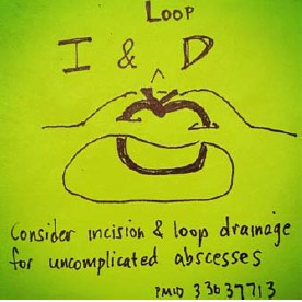 #EPs should consider using the #incision & #loopdrainage technique instead of conventional I&D for uncomplicated #subcutaneous #abscesses, says @M_Lin Benefits include a smaller scar & no packing changes. #FOAMed ow.ly/19QK50PGRbi