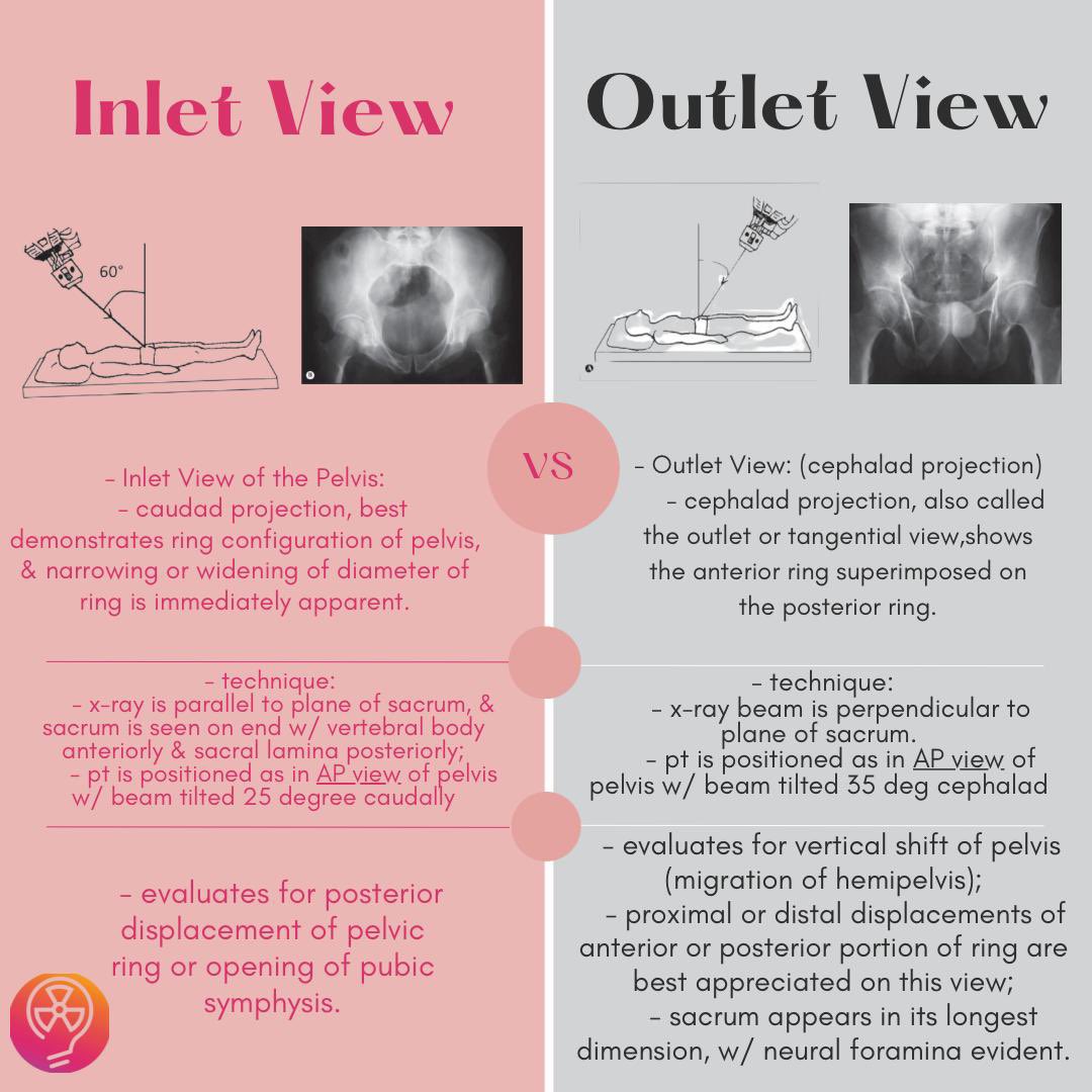 Maternal Pelvis - New, image size:1080x1080