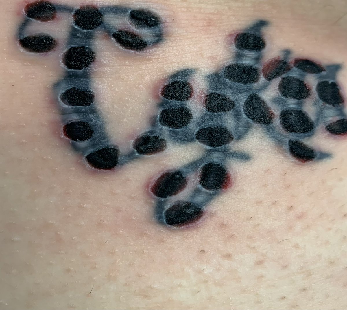 dootsandhoops's tweet photo. before and after of first tattoo removal lol https://t.co/p0VXkm4UO2