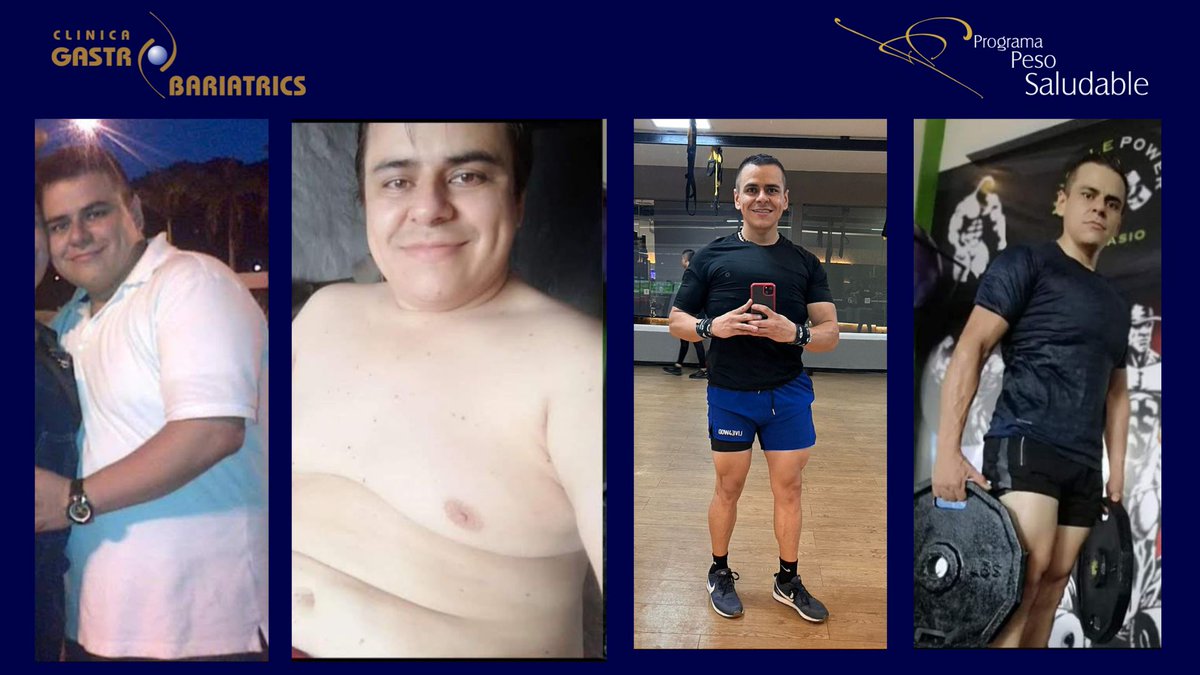 ¡Compartimos con ustedes la evolución de uno de nuestros paciente de Manga Gástrica!

PROGRAMA PESO SALUDABLE
programapesosaludable.com