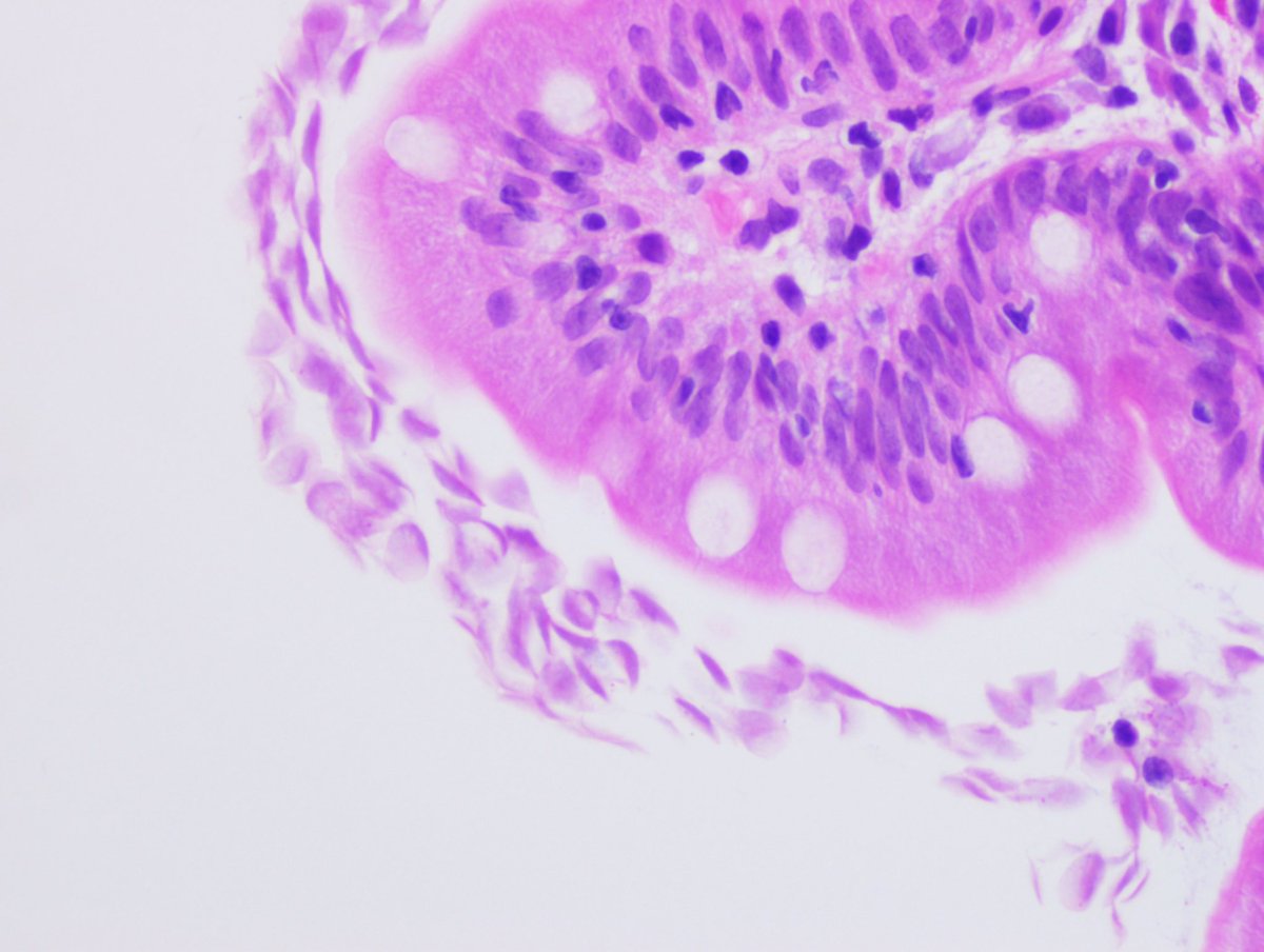 Is it unfair to say every pathology resident should know what this is? #pathology #gipath #pathbugs #crittersontwitter #pathtwitter #pathboards #knoworfail