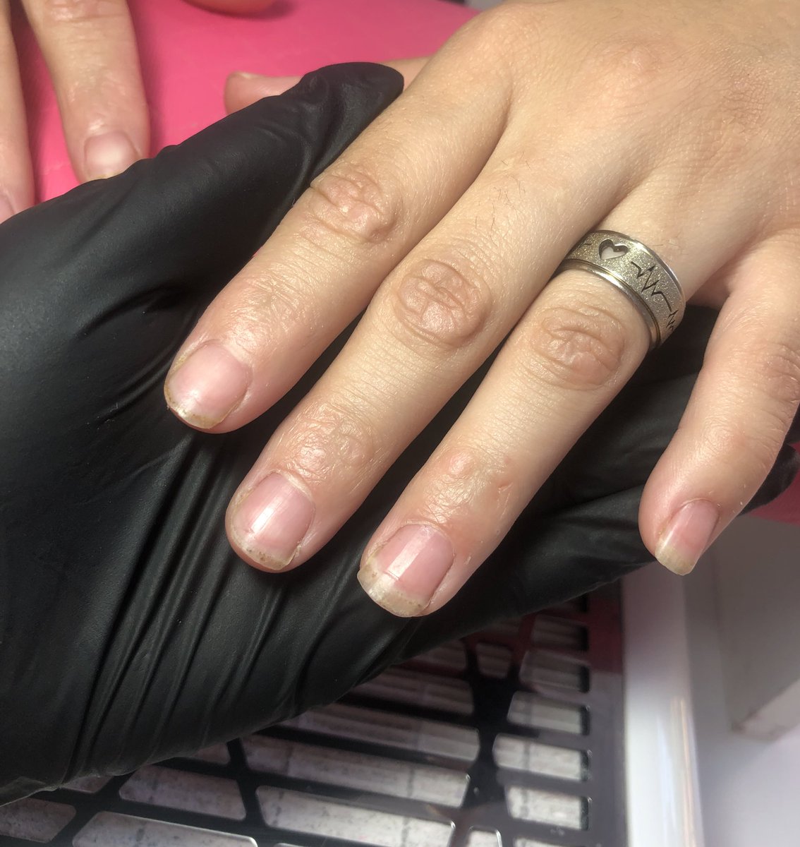 _annemoraess's tweet photo. Alongamento fibra de vidro 
Francesinha permanente 💅🏻 

Antes e Depois 

#alongamentodeunhas #unhas #unhasemgel #fibradevidro #esmaltacaoemgel #francesinha #almond #unhasdecoradas #nailart #unhasbrasil https://t.co/MJOhkwkEM9