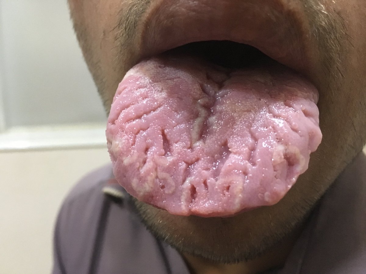 Tariq Mir 🇵🇰 tweet media