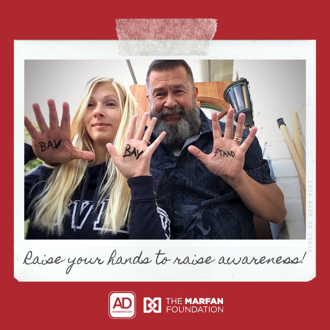 Why keep talking about #aortaED? Well its not for those who survived. Its all about those still not ill, who we hopefully can save by knowledge, prevention and appropriate care if and when they need it. Its all about our kids, family and friends. BIG HUG. Today its #September19