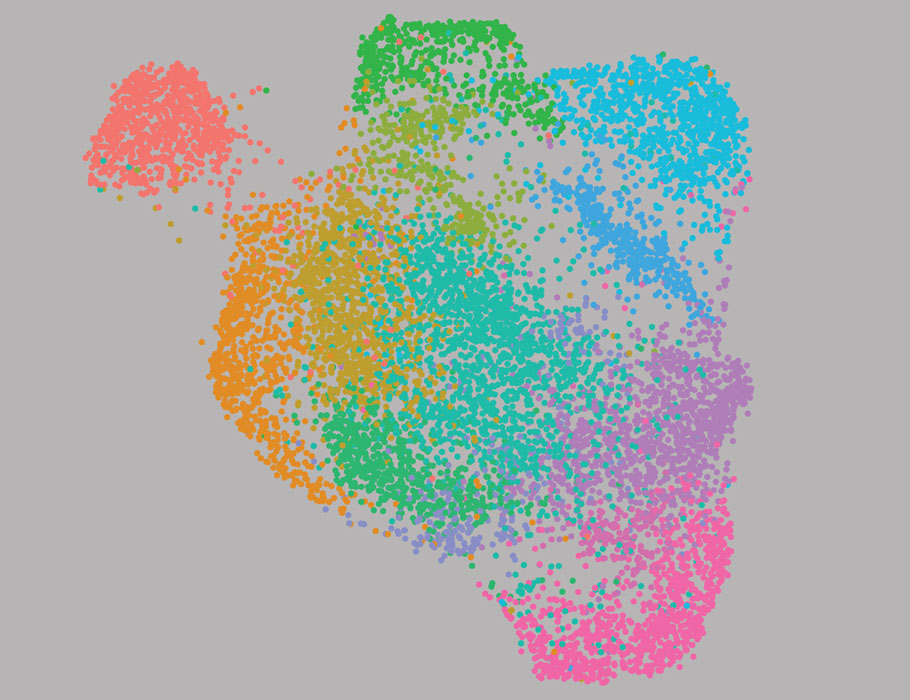 SciImmunology's tweet photo. New research from @Vignali_Lab involving human data identifies a tumor-specific population of immunosuppressive regulatory T cells dependent on BATF and associated with poorer outcomes for head and neck squamous cell carcinomas. @PittTweet

📄: https://t.co/qm5Fvls0q0 https://t.co/wRHLTcLNJl