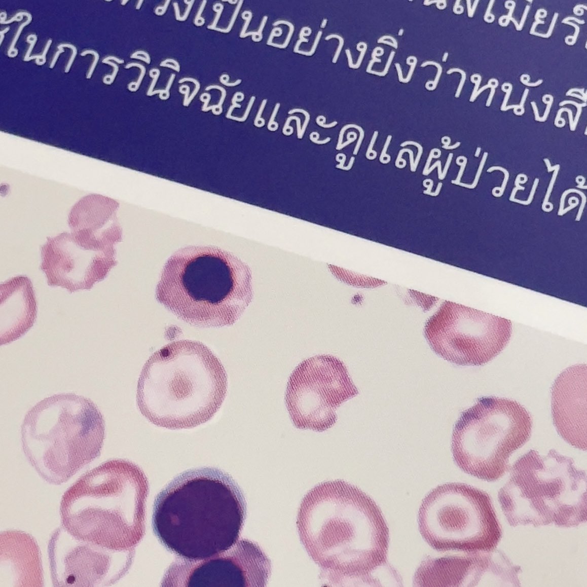 เริ่มจะอยากเป็นผู้ป่วยแทน