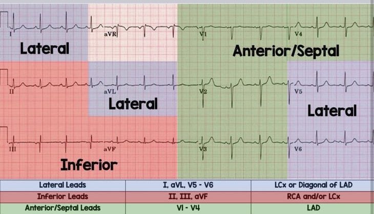 Caras del corazón en el EKG 🫀 Aprende: shop.beacons.ai/farmacotips_/0…