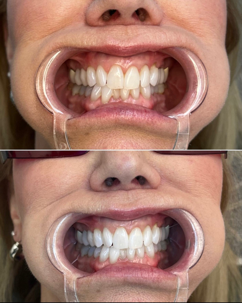 foreverbyash's tweet photo. Our teeth whitening services are top-of-the-line and guaranteed to make you feel more confident about your smile. Visit our website for more information!

#TeethWhiteningService https://t.co/iVY1R1SOOa https://t.co/2EESa6p4Q4
