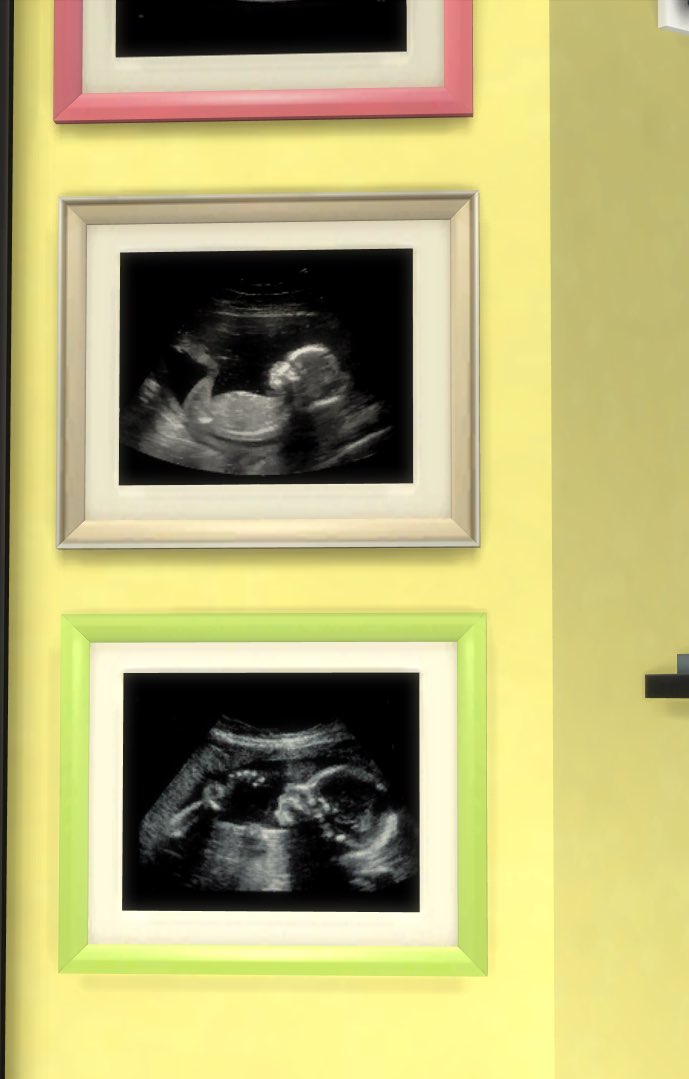 yourdecoysims's tweet image. 🌟Yellow Generation🌟
#NotSoBerryChallenge 

Every stage of the pregnancy 😆 She was getting her regular checkups! 

Yeva had baby boy Gabril Berry-Mezmarat. He is 1/4 werewolf, 1/4 human, &amp;amp; 1/2 vampire. I wonder if he will be any of the occult or just human 

#sims4