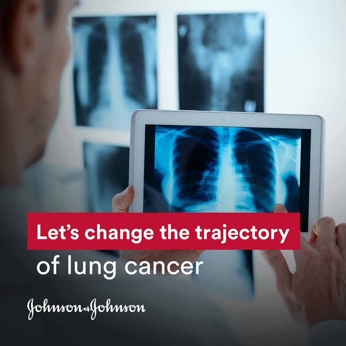 Early detection of lung #cancer is crucial for better survival rates. Over 40% of cases are diagnosed at stage four, but at stage one, the five-year survival rate can reach 68-92%! I share how we can change the trajectory of lung cancer in Europe!👉linkedin.com/pulse/lets-cha…