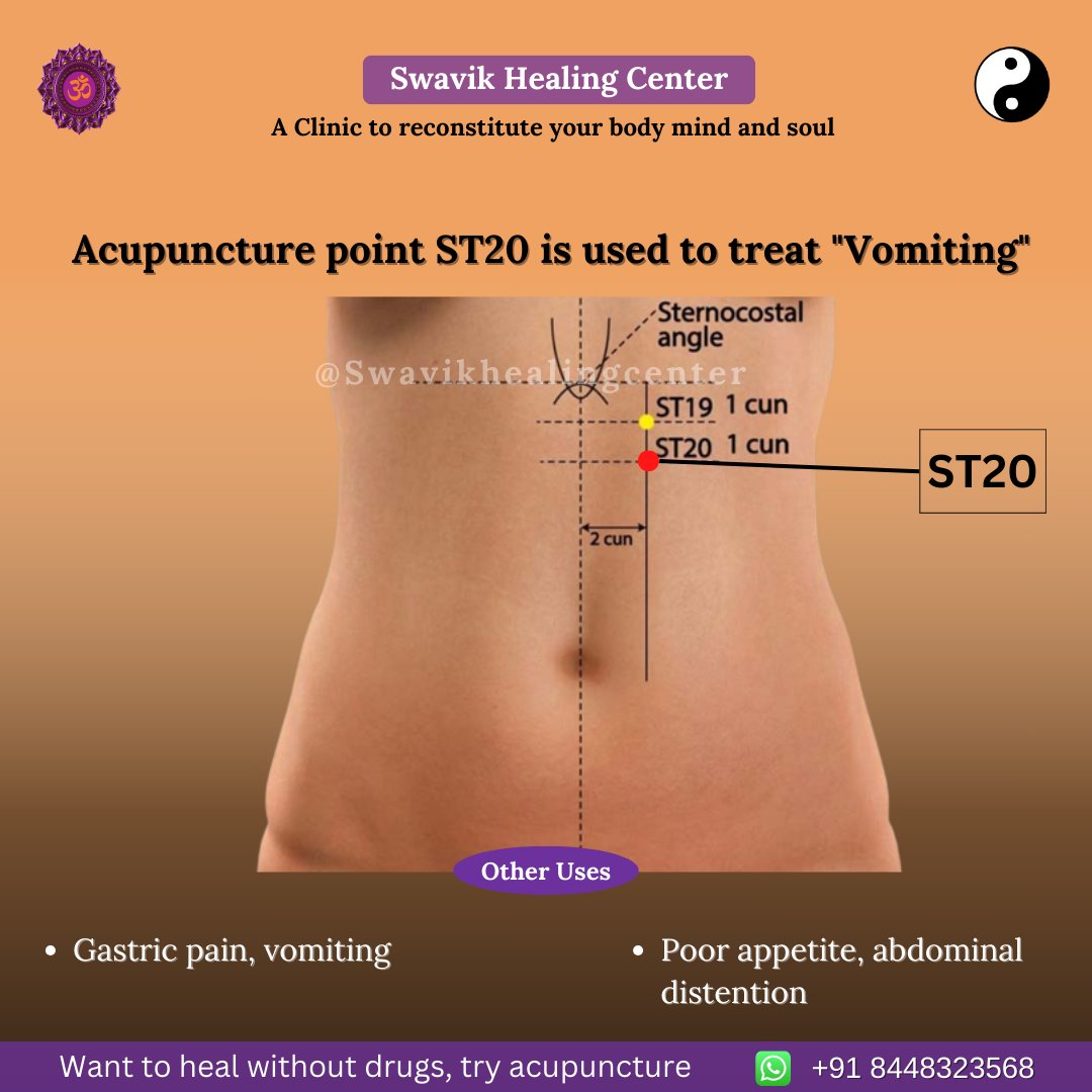 ➡️ Acupuncture point ST20 is used to treat 'Vomiting'

#acupunctureclinic #acupuncture #acupuncturepoints #naturaltreatment #Palamvihar #gurugram #treatment #acupuncturetreatment #acupuncturetherapy #vomiting #stomachpain #stomacht #appetite #appetitecontrol #abdominal #gastric