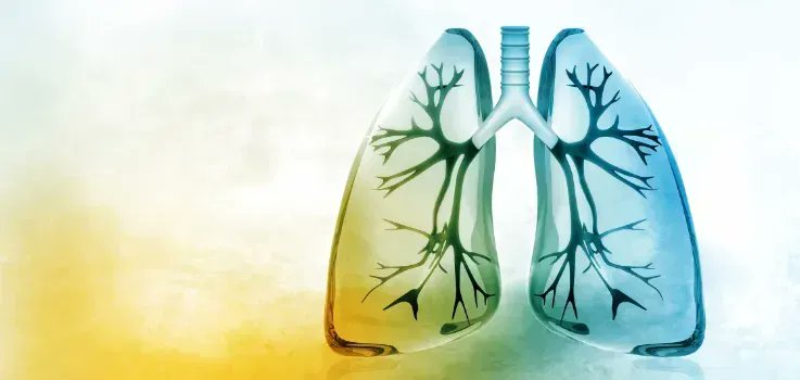 Researchers from the BDI are involved in a new study which has received funding to develop novel imaging, #AI-methods and targeted treatment for therapy-resistant #lungcancer. 💊 💻 Read more 👉 buff.ly/3PKrDgL @bwpapiez
