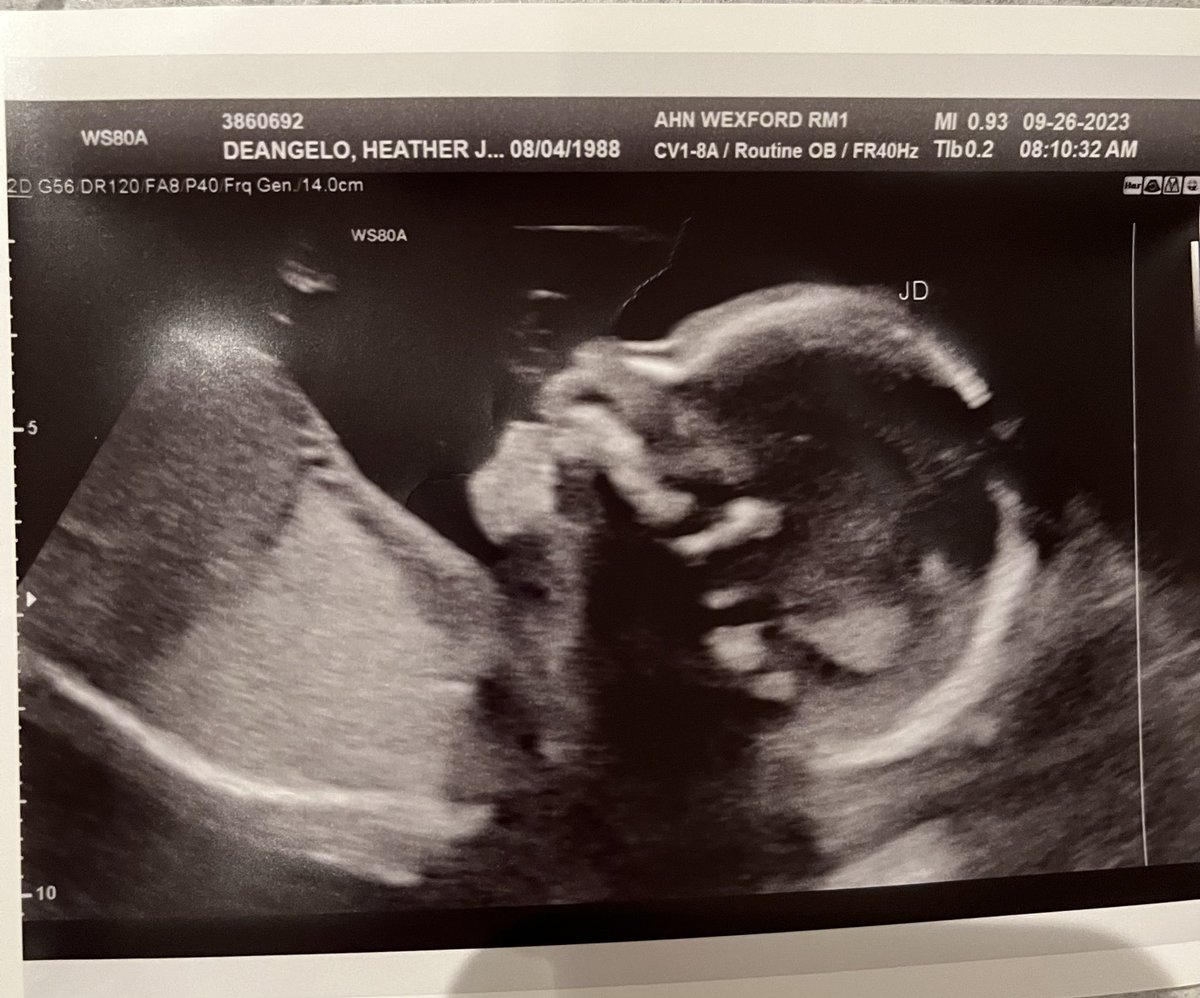 hetdeangelo's tweet photo. It’s very fitting that we just celebrated Daughter’s Day, as we had our ultrasound today and confirmed that Piper is going to have a little sister! ❤️  @MarcusPDeAngelo https://t.co/kQFZkLoBmE