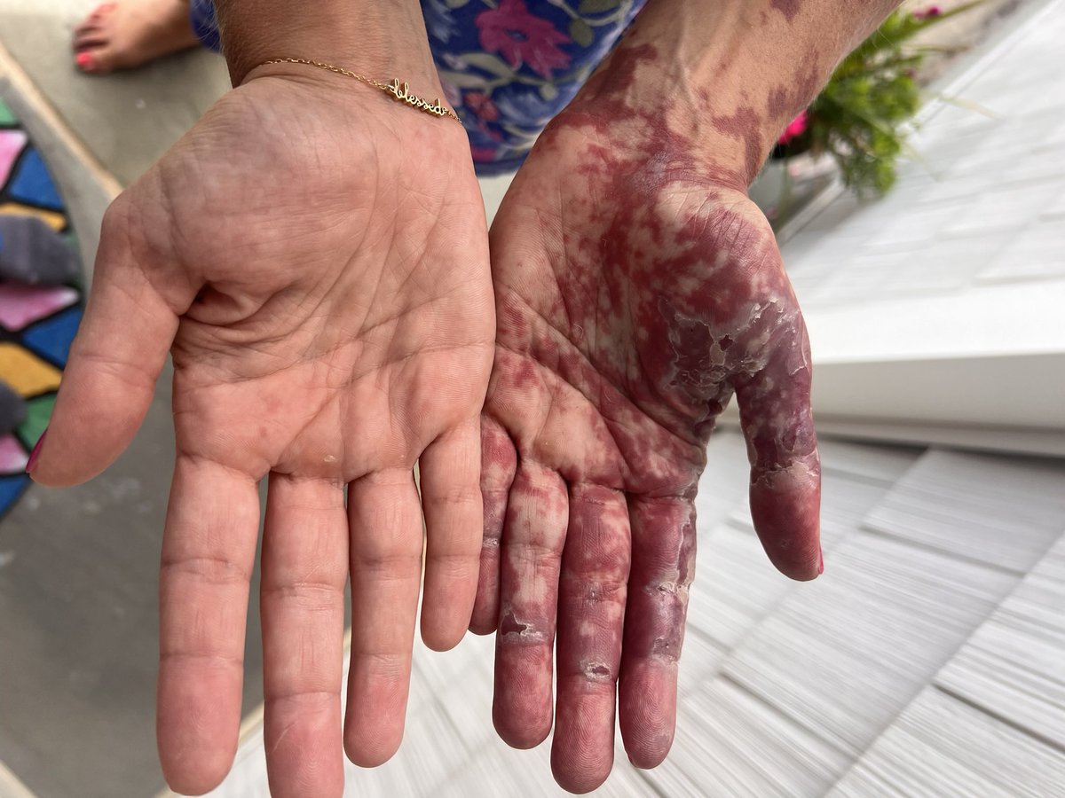 lisaafars3's tweet photo. I’M A CHILDREN’S BOOK AUTHOR!! Check out my book, Tattoo on my Heart, on @amazon ! It is a story, inspired by my sister, about the power of words as a young girl faces adversity because she is born with port-wine stain. https://t.co/tx92khX3s0 @LeaphartElem @LexRich5Schools https://t.co/579j78AiQu