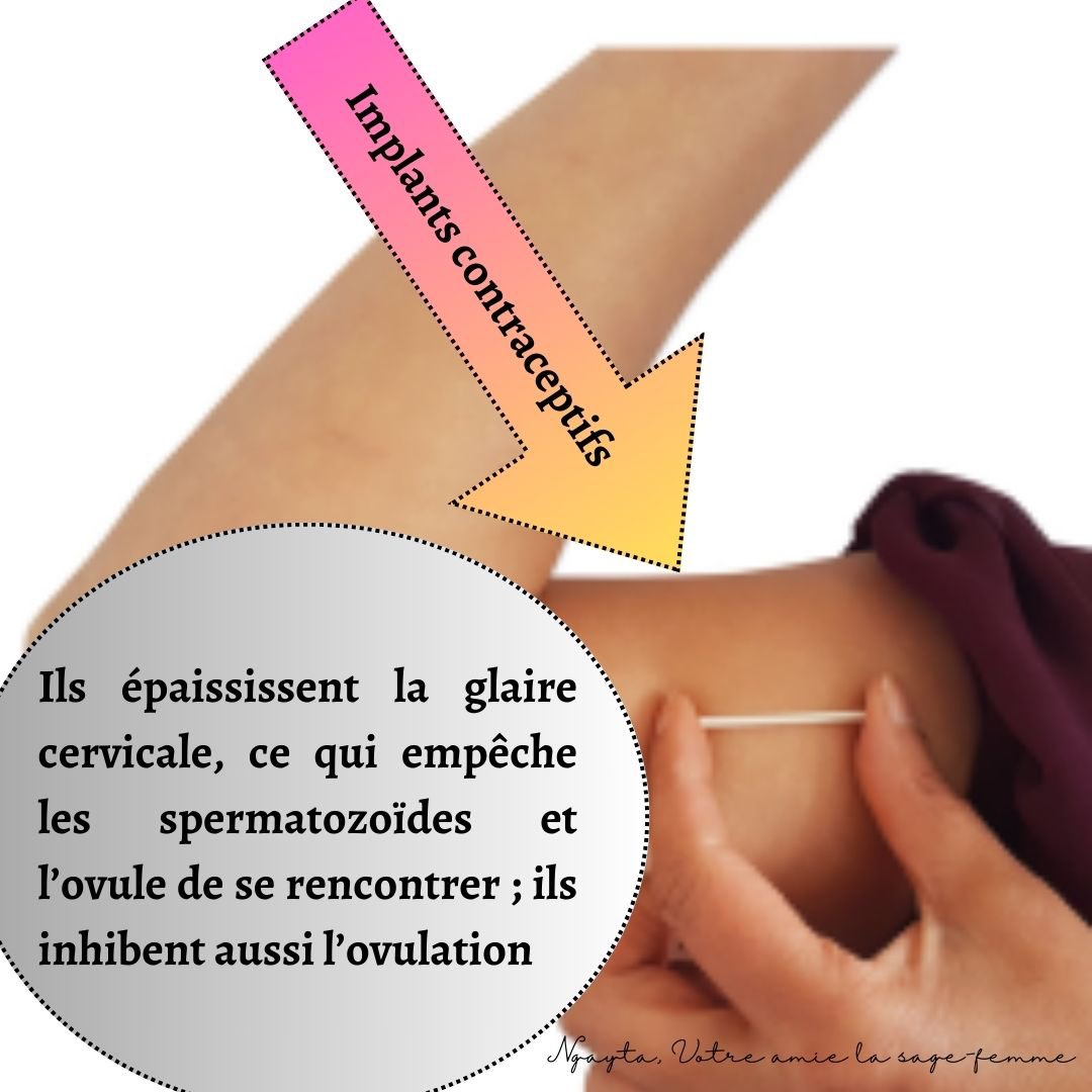 ngaytazo's tweet photo. Comprendre les méthodes contraceptives
Post 2 méthodes hormonales
Quelles autres méthodes connaissez vous à part ceux la ?
#ContraceptionConversations https://t.co/CHB2XEidEx