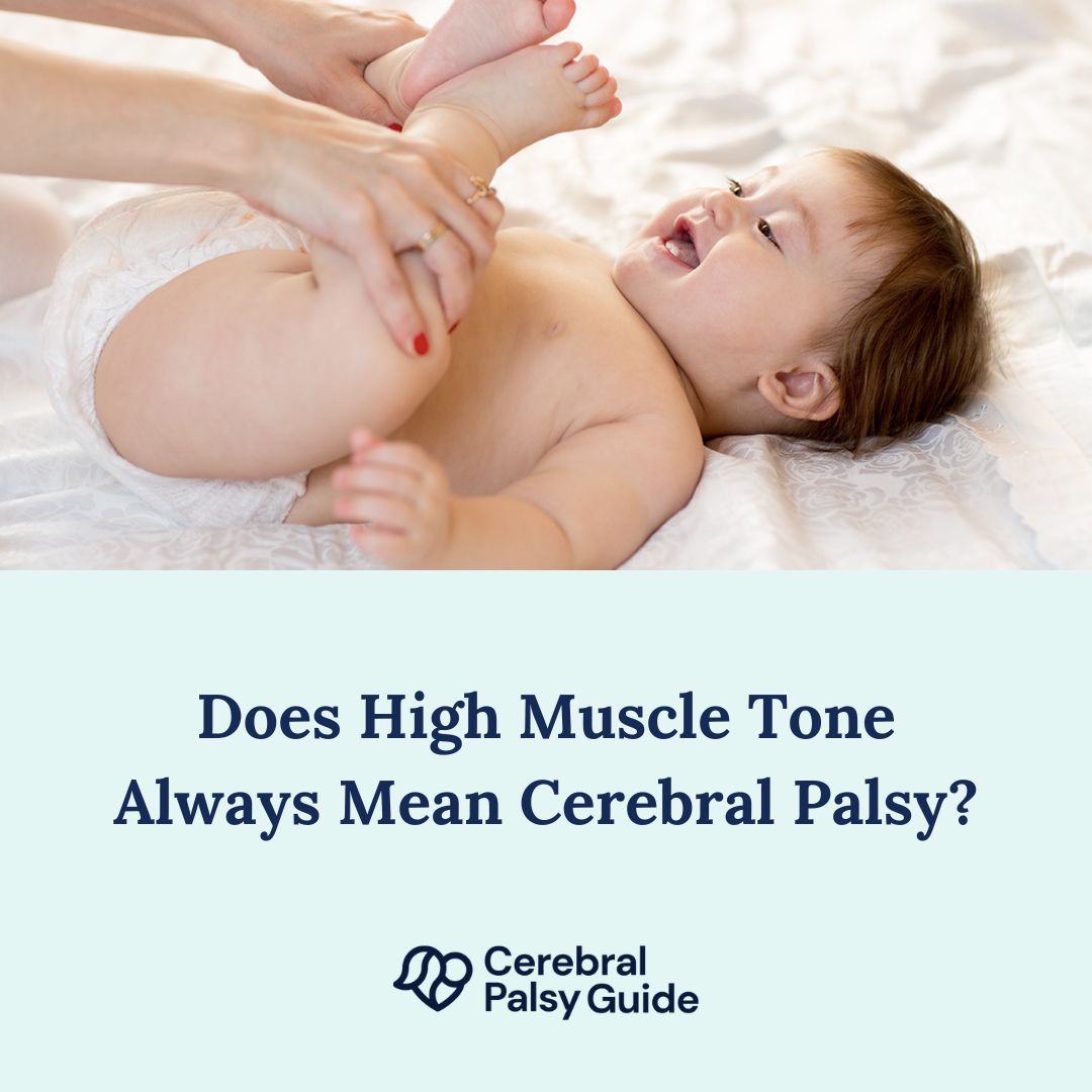 CP_Guide's tweet image. Is your child struggling with #hypertonia or high muscle tone, but you're unsure if it's linked to #cerebralpalsy? Learn about the connection between the two conditions and how you might be able to access help: bit.ly/3PsuysW
