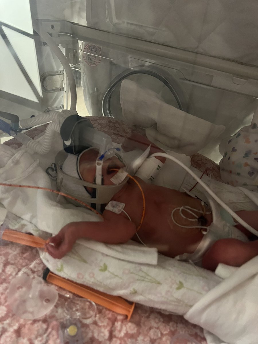 Little Sadie Miller is here ❤️ 10 weeks early and already hollerin’ around the NICU ❤️