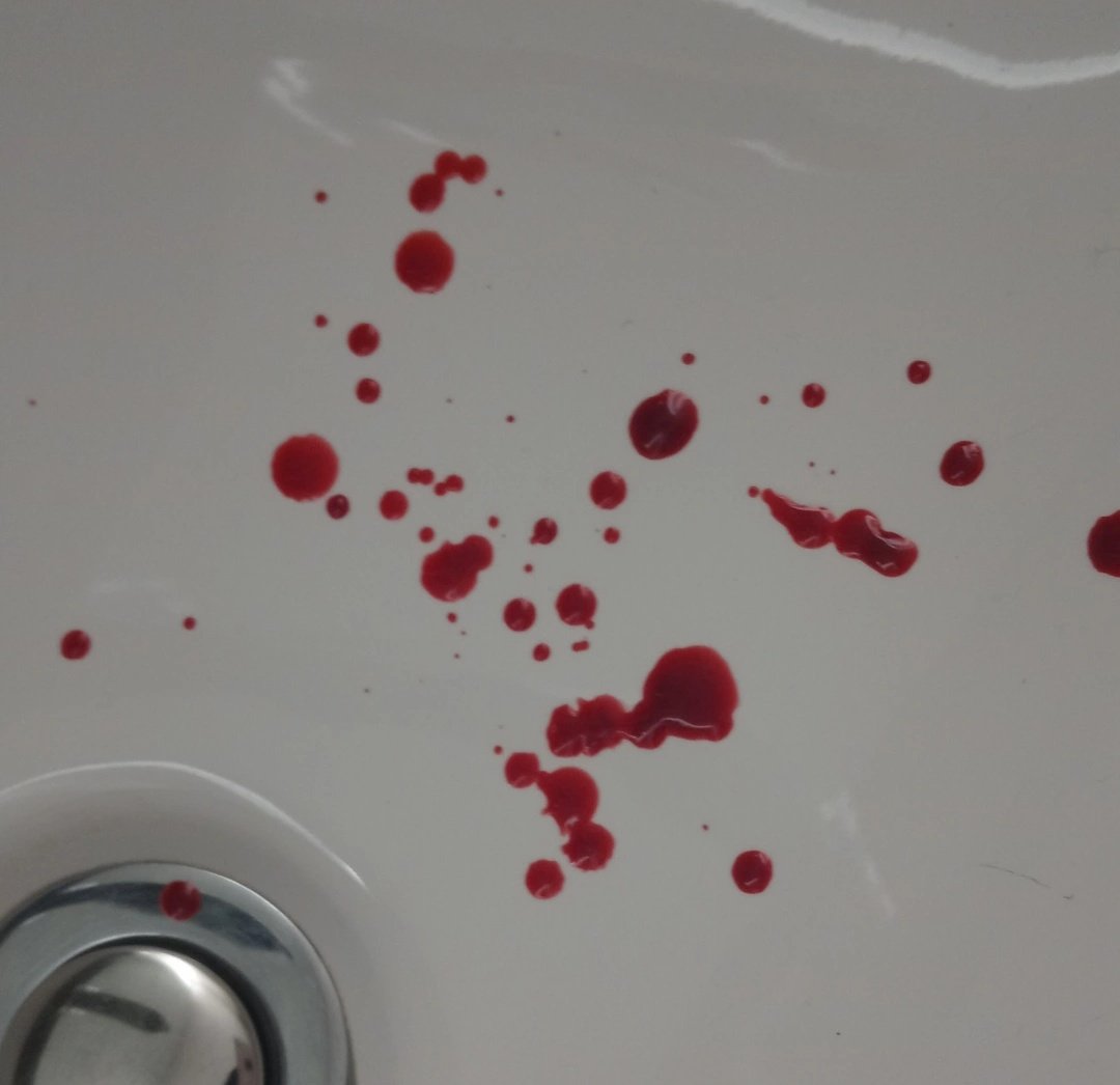 liatvrts's tweet photo. i lowkey love it when my nose bleeds :3 ❤ https://t.co/HlqlIVlq09