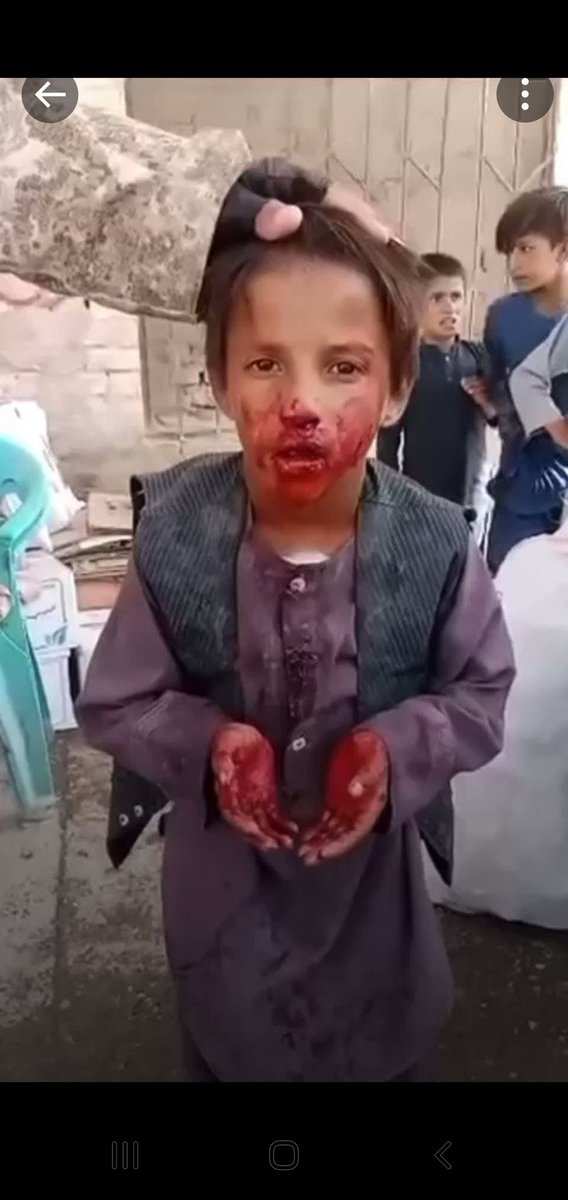 #پاکستان د ښۀ ګاونډیتوب شعار پۀ عمل کې ثابتوي.😢
د #افغان ماشوم دا مظلومه سلګۍ به د عرش حجاب ولړزوي او د ظالم کثیفه څهره بۀ د نړۍ لۀ نقشې حذف کړي ان شاء الله.☝