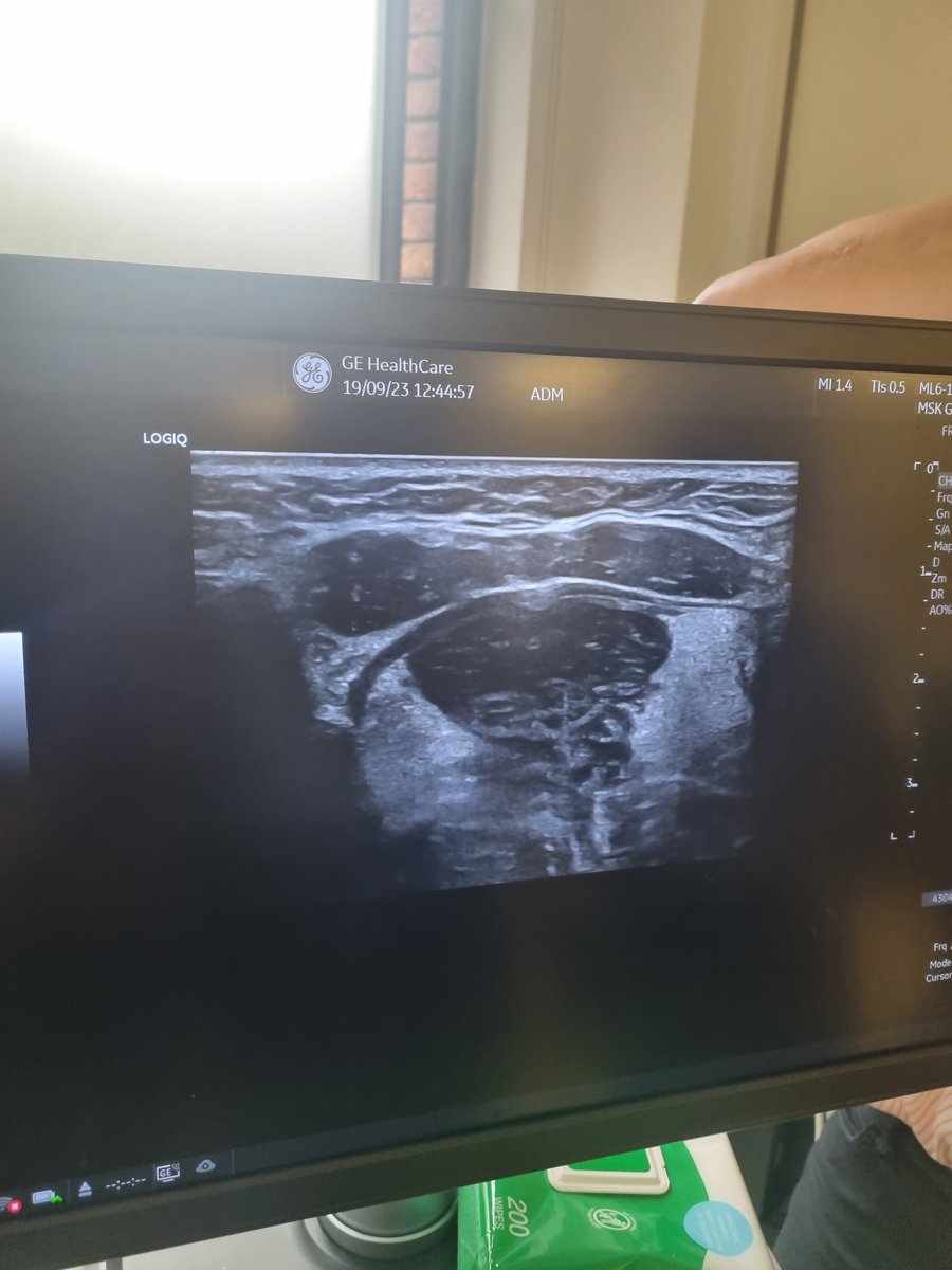 amyendacott's tweet photo. AMAZING day @SltUltrasound discussing practical skills + clinical applications. US of head/ neck/airway is very promising in supporting SLT's to understand more about pathophysiology = more effective therapy! Thank you @JodiAllenSLT @claire_slinger @DrJoanMa1 @DrJoanneCleland https://t.co/hGyE1SNc3u