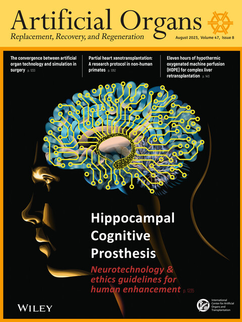 New joint paper on with @yjerden on ethics of #Hippocampal #CognitiveProsthesis. Neurotechnology & ethics guidelines for #HumanEnhancement in @ArtifOrgans #OnTheCover