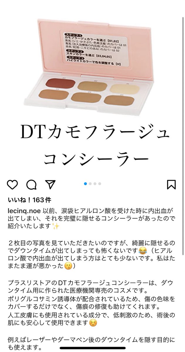 an_ranmaru0117's tweet photo. 一応動画見ながらやってみたけどさすがに内出血が濃すぎるのか隠しきれなかった😭😭18日から冷やしてたから今日からは温めてアーバンで買ったクリームを引き続き塗りまくろう😭😭💕 https://t.co/CLsiKTNaE2