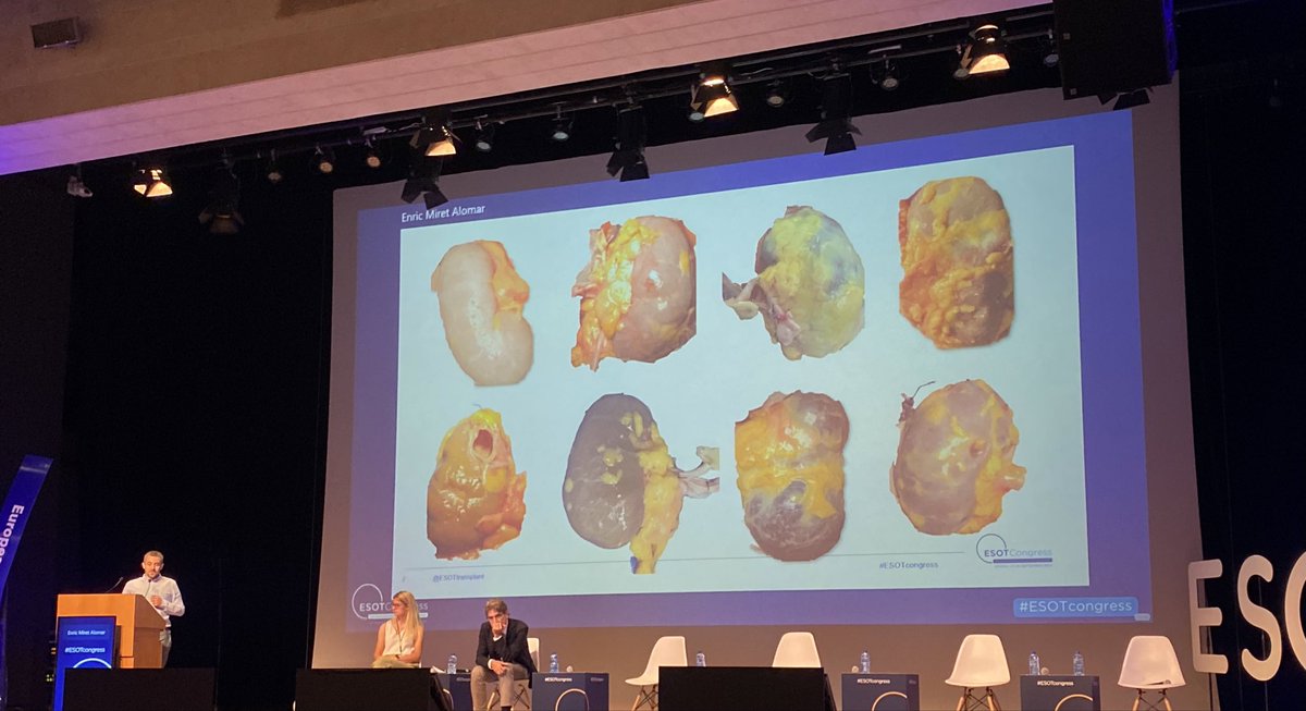 GavaraGomez's tweet image. Excellent talk by @MiretAlomar at #ESOTcongress in Athens and interesting discussion. KidneyColor developped by @VHIR_ @vallhebron and @UPFBarcelona. Great team @Dra_Itx_Bilbao and @enrique_trilla.