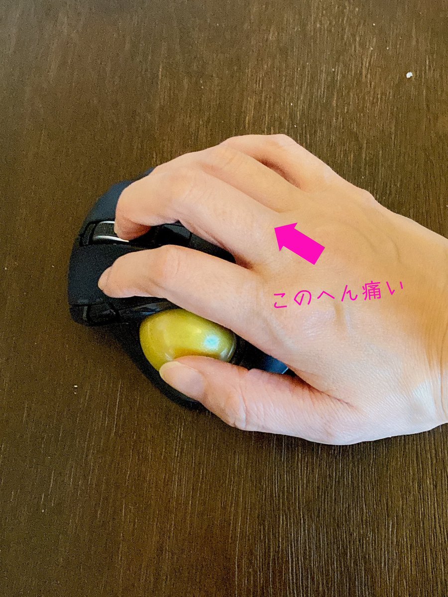 a3osd's tweet photo. トラックボールのホイールを中指で操作しがちなんだけど、指の付け根がなんだか痛い。

身体に痛みが出る時は、ストレス対策しろってメッセージだと思ってる。 https://t.co/kh98TBQhMo